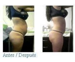 lipusuccion sin cirugia ultracavitacion lipusuccion sin cirugia ultracavitacion